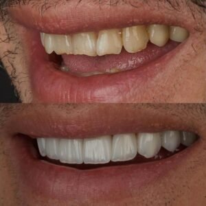 ddbb7a15 247d 4745 8e52 a2bdd350b48d