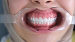 431f2cfb 7ac8 4b50 ade0 4a8dc2ac3db1